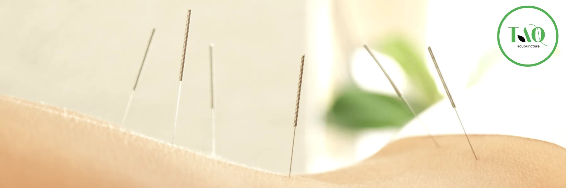 Tao Acupuncture Thierry Gauthier