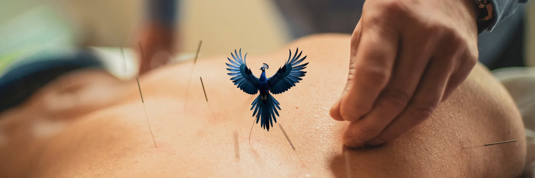 Richard Bijaoui Acupuncture