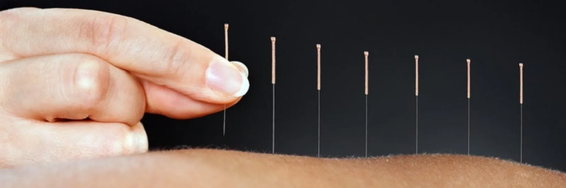 Laetitia Barraud | Acupuncture Morges