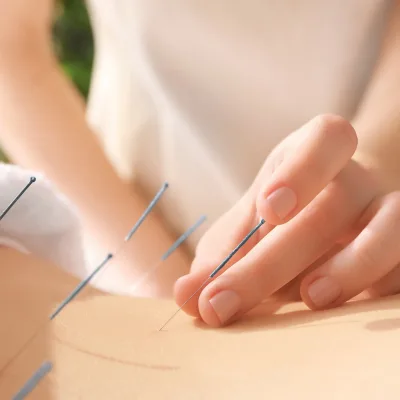 Découvrez l'Acupuncture : Origines, Principes et Techniques de Base