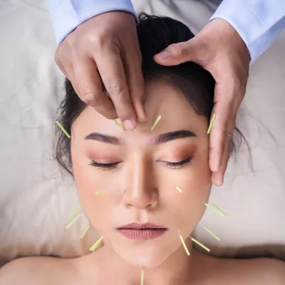 Les Mythes Courants sur l'Acupuncture : Démystification d'une Pratique Ancienne