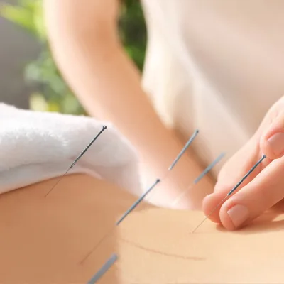 Sécurité et Précautions en Acupuncture : Votre Guide pour des Soins en Toute Confiance
